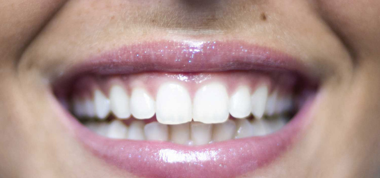 sorriso dentista figlioli palermo