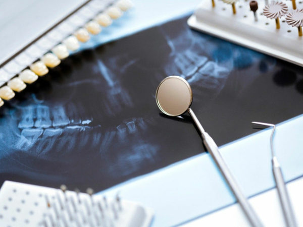 strumenti dentista